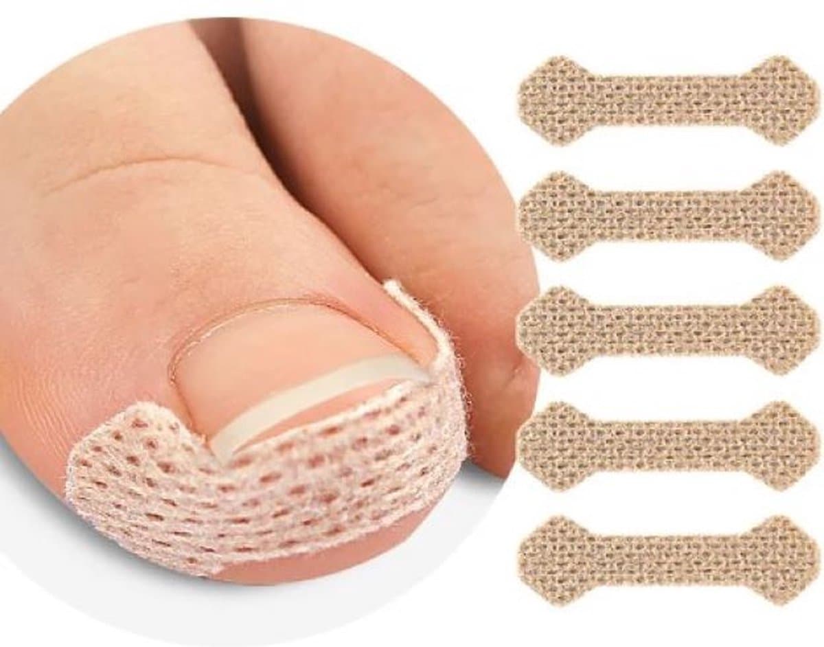 Ingegroeide teennagel - teennagel corrector - 40 stickers